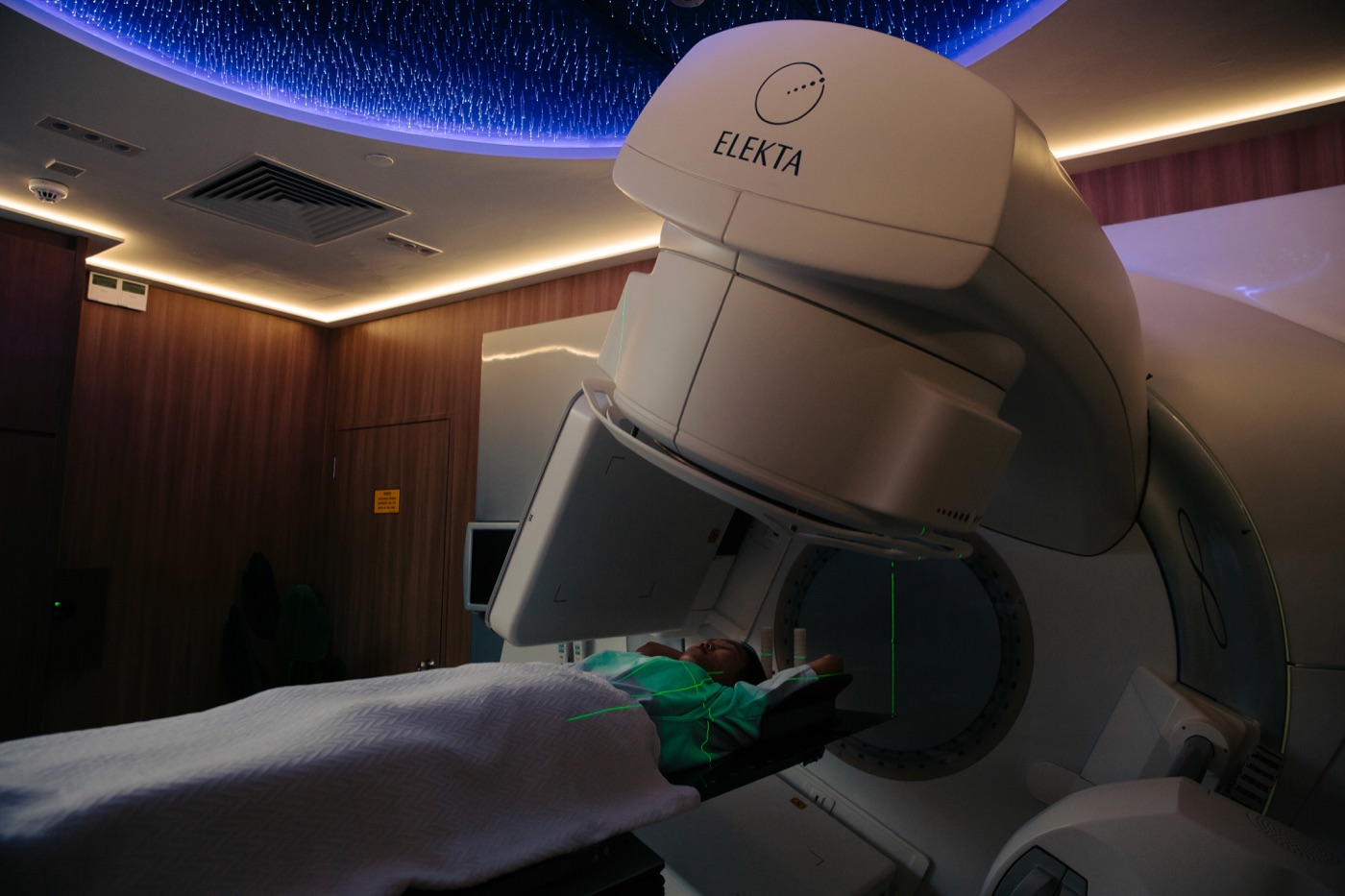 Linear accelerator used to deliver prostate SBRT